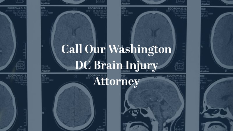 Call Our Washington DC Brain Injury Attorney